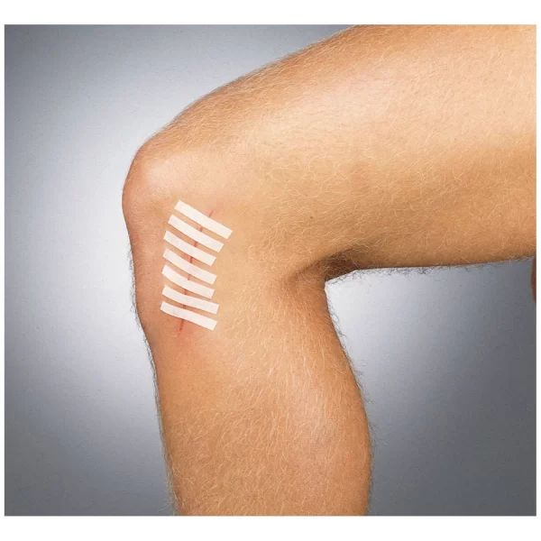 INTEGRA LIFESCIENCES SUTURE STRIP WOUND CLOSURE STRIPS