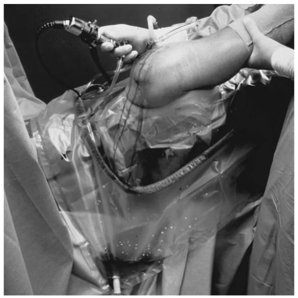 3M STERI-DRAPE U-DRAPES