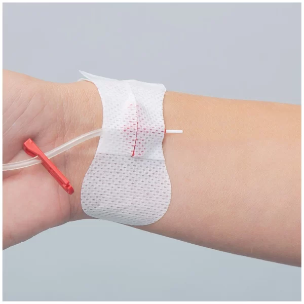 TIDI GRIP-LOK ARTERIAL CATHETER SECUREMENT DEVICE