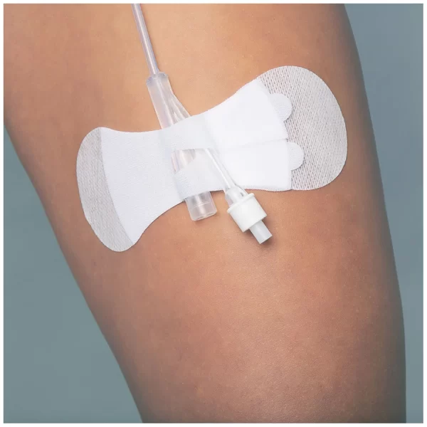 TIDI GRIP-LOK FOLEY SECUREMENT DEVICE